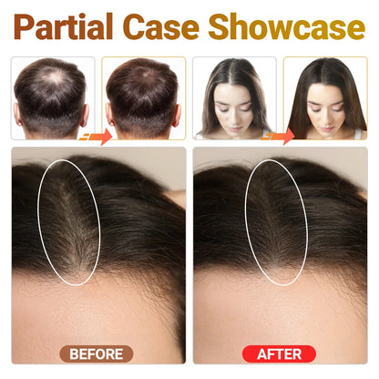 Tri-Chroma Photon Hair Therapy Device Professional LLLT Laser Hair Growth Anti Hair Loss Treatment Thinning Scalp Stress Relief