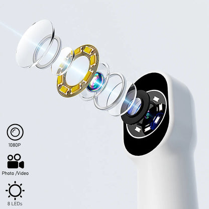 Handheld 1080P WiFi Endoscope Oral Camera with 8 LED Lights Compatible with iPhone, Android & Type-C for Dental/Tooth Inspection