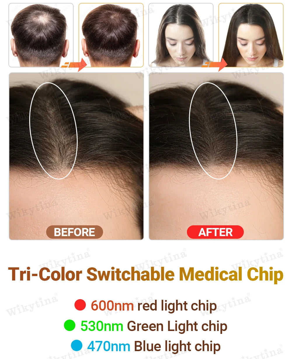Tri-Chroma Photon Hair Therapy Device Professional LLLT Laser Hair Growth Anti Hair Loss Treatment Thinning Scalp Stress Relief